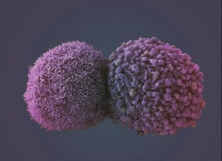 Названо самое опасное осложнение коронавируса COVID-19