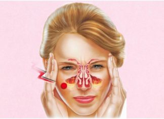 Осложнения катарального синусита. Осложнения катарального синусита.