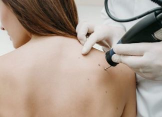 Лазерное удаление бородавок: описание процедуры, подготовка к операции, особенности и преимущества Лазерное удаление бородавок: описание процедуры, подготовка к операции, особенности и преимущества