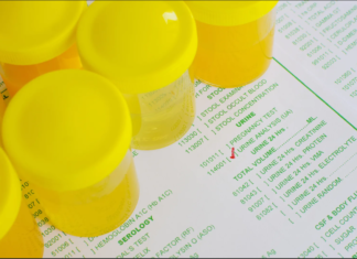 Анализ мочи по Зимницкому — все, что вам нужно знать об этом тесте Анализ мочи по Зимницкому - все, что вам нужно знать об этом тесте