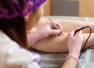 Аппарат для электроэпиляции