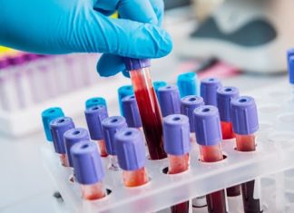 Инновации в лабораторной диагностике: комфорт и уверенность