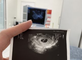 10 мифов о медикаментозном аборте — Клиника «ЛИЦ» — современный медицинский центр в СПб