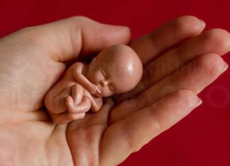 Аборты: показания, методы, разрешенные сроки