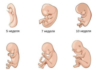 Антенатальная гибель плода: причины, симптомы и лечение в статье гинеколога Кондратенко Ю. Н.