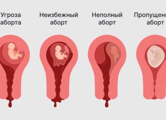 Чем вызвано кровотечение при беременности на ранних сроках