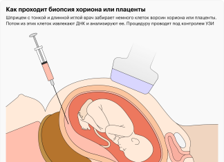 Генетический тест при беременности | Pampers