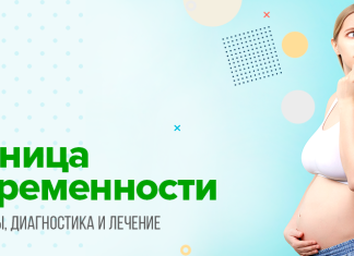 Молочница во время беременности. Как избежать рисков? | «За Рождение» Киров