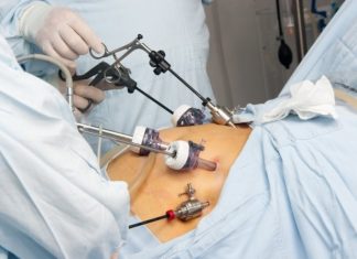 Операция при внематочной беременности – лапароскопия, лапаротомия