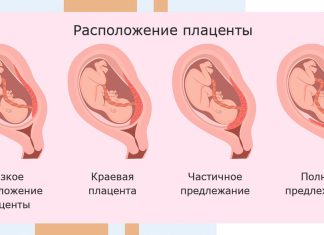 Осложнения беременности во втором ( II ) и третьем ( III ) триместре при многоплодии. Плацентарная недостаточность.
