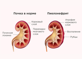 Патология беременности: описание, симптомы, диагностика и лечение | ЛабСтори