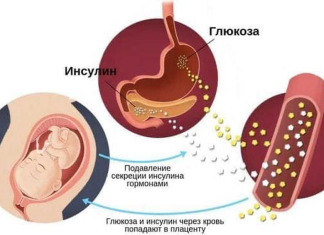 Сахарный диабет и беременность