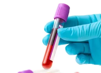 Тромботические осложнения: как просчитать риски — рассказывает врач-гемостазиолог Нова Клиник