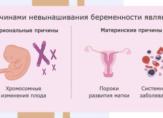 Замершая беременность