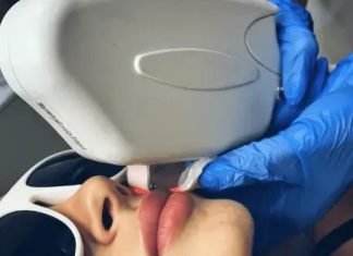 Что такое лазерная эпиляция?