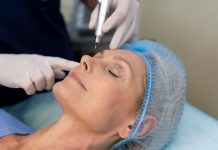 Микроигольчатый RF-лифтинг: инновационный метод омоложения