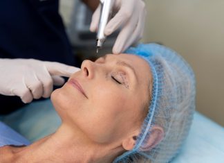 Микроигольчатый RF-лифтинг: инновационный метод омоложения