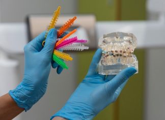 Брекеты: какие бывают виды, особенности систем и стоимость установки