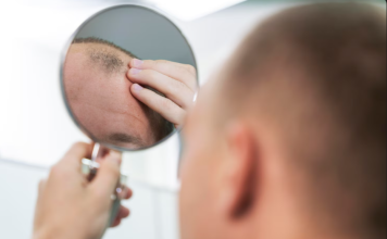 Исправление неудачной пересадки волос: причины, методы коррекции и восстановление